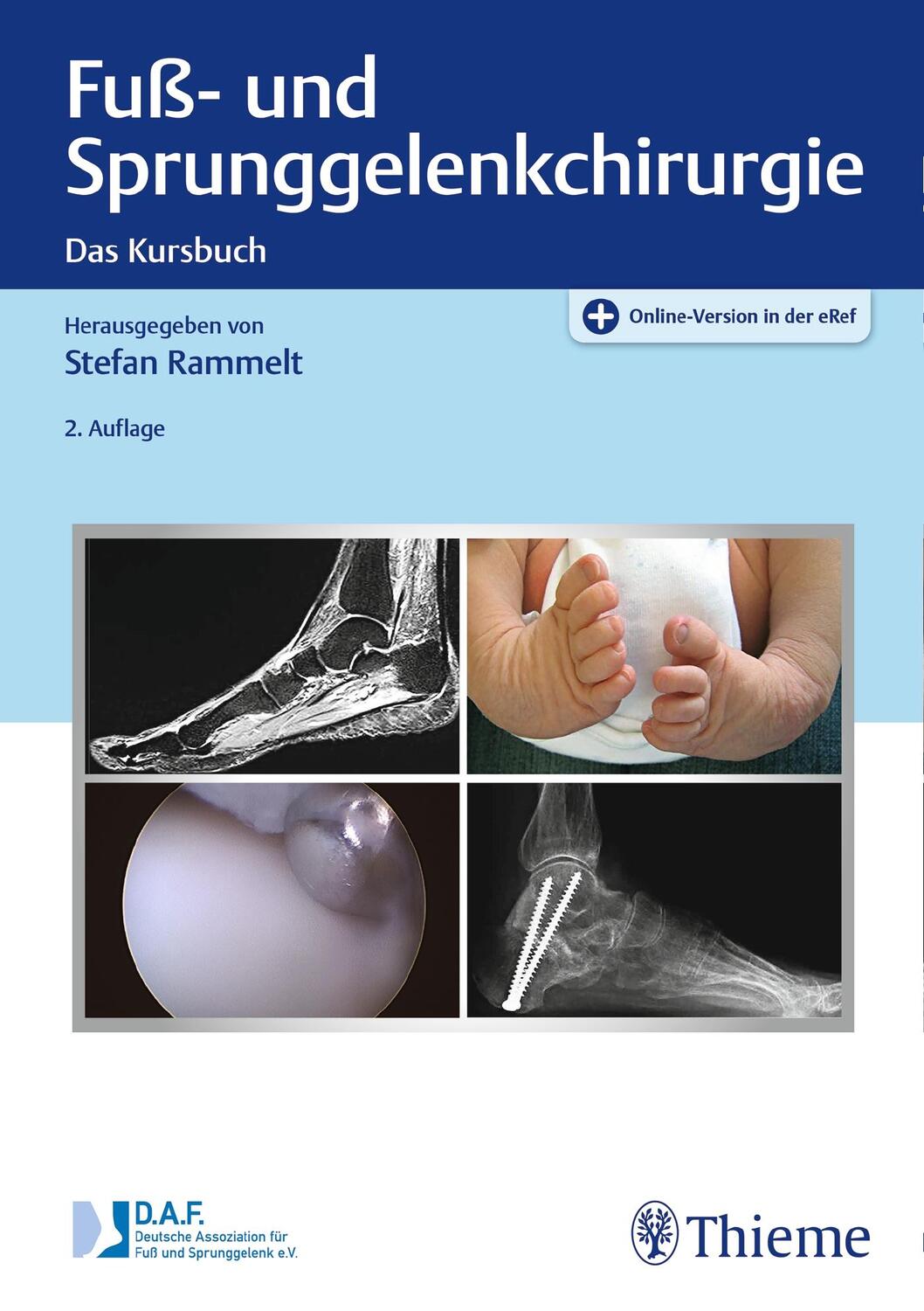 Cover: 9783132419834 | Fuß- und Sprunggelenkchirurgie | Das Kursbuch | Stefan Rammelt | 2021
