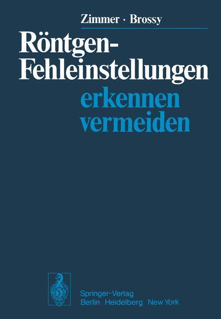 Cover: 9783642962646 | Röntgen-Fehleinstellungen | Erkennen und vermeiden | M. Brossy (u. a.)