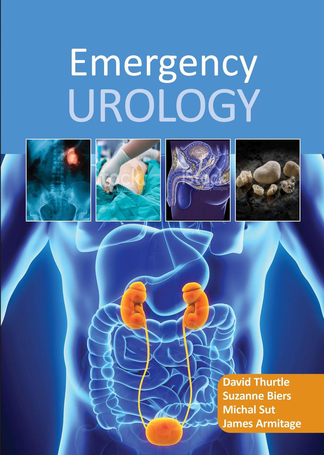 Cover: 9781910079423 | Emergency Urology | David Thurtle (u. a.) | Taschenbuch | Englisch