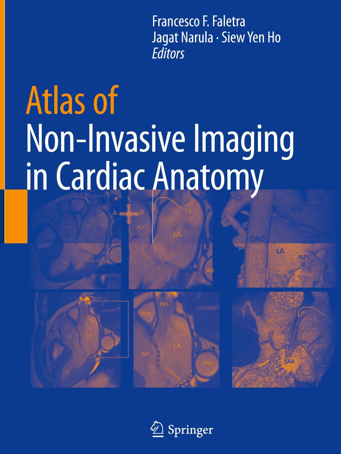 Cover: 9783030355050 | Atlas of Non-Invasive Imaging in Cardiac Anatomy | Faletra (u. a.)
