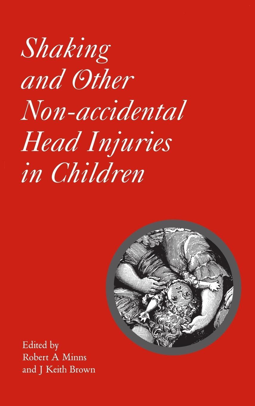 Cover: 9781898683353 | Shaking and Other Non-accidental Head Injuries in Children | Minns