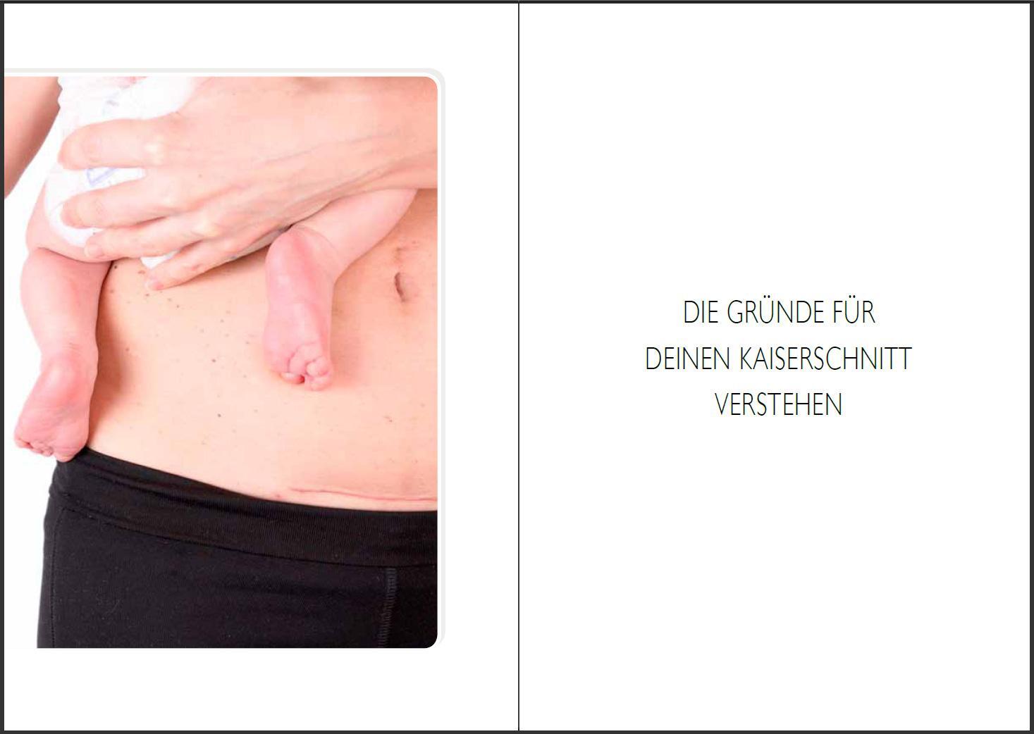 Bild: 9783990820582 | Natürliche Geburt nach Kaiserschnitt: Praxis-Wissen von der Ärztin...