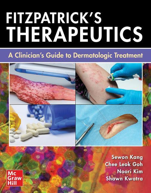 Cover: 9781264258932 | Fitzpatrick's Therapeutics: A Clinician's Guide to Dermatologic...