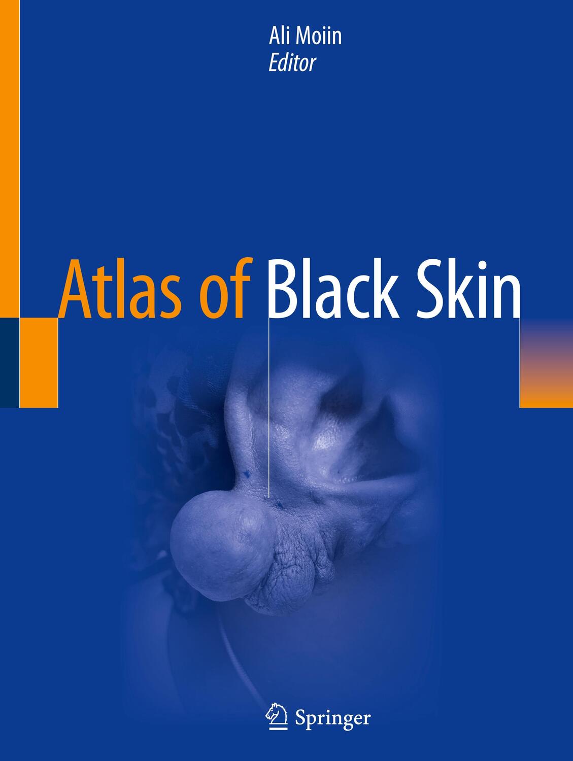 Cover: 9783030314873 | Atlas of Black Skin | Ali Moiin | Taschenbuch | Paperback | xiii