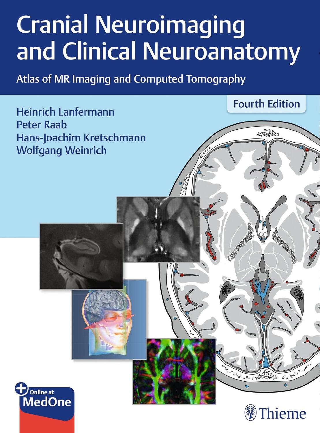 Cover: 9783136726044 | Cranial Neuroimaging and Clinical Neuroanatomy | Lanfermann (u. a.)