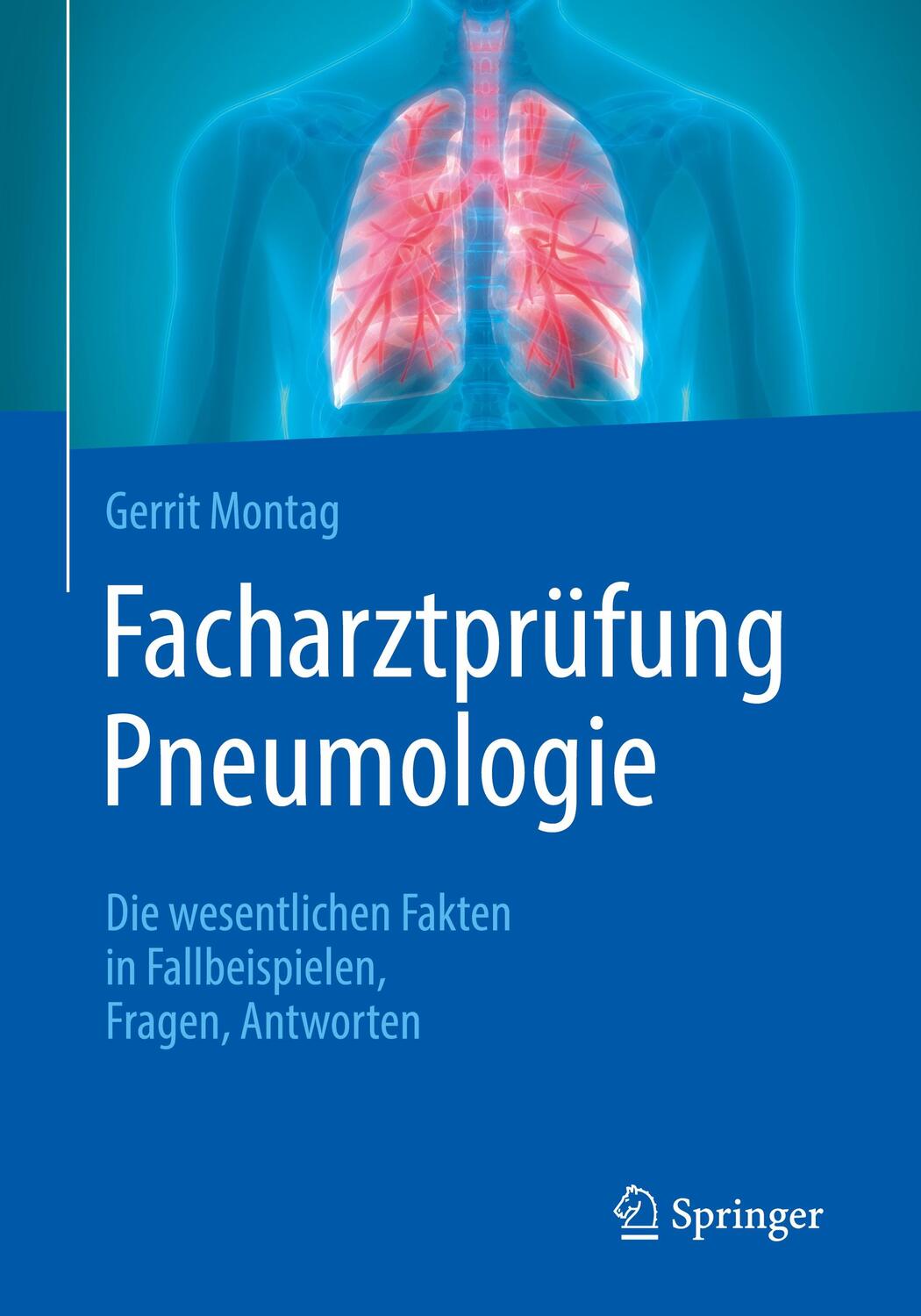 Cover: 9783662615737 | Facharztprüfung Pneumologie | Gerrit Montag | Taschenbuch | Paperback