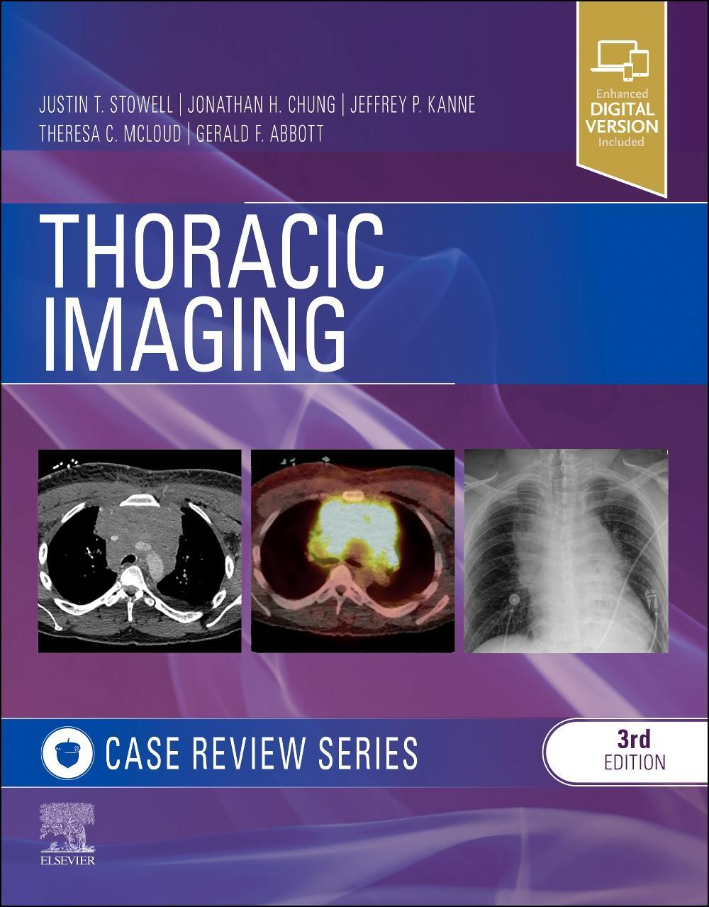 Cover: 9780323428798 | Thoracic Imaging: Case Review | Justin T., MD Stowell (u. a.) | Buch