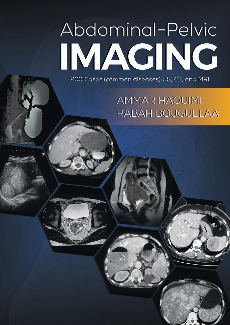 Cover: 9781528937153 | Abdominal-Pelvic Imaging | Ammar Haouimi (u. a.) | Taschenbuch | 2021