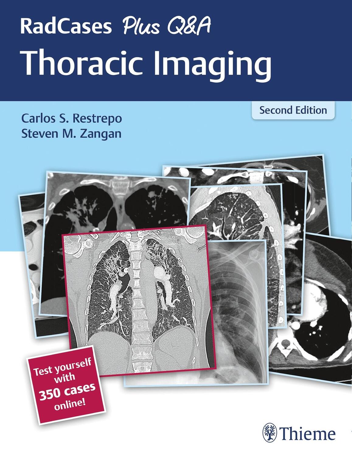 Cover: 9781626238145 | RadCases Plus Q&A Thoracic Imaging | Carlos S Restrepo (u. a.) | Buch