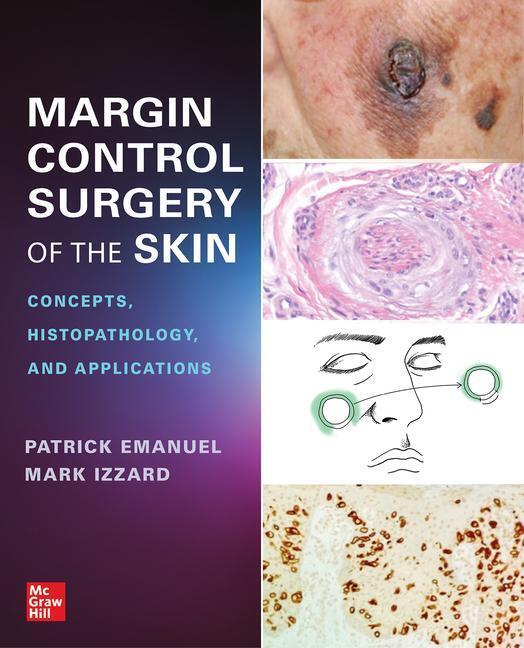 Cover: 9781264285990 | Margin Control Surgery of the Skin: Concepts, Histopathology, and...