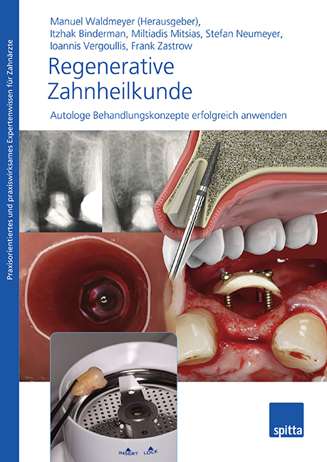 Cover: 9783946761716 | Regenerative Zahnheilkunde, m. 1 Video | Manuel Waldmeyer | Buch