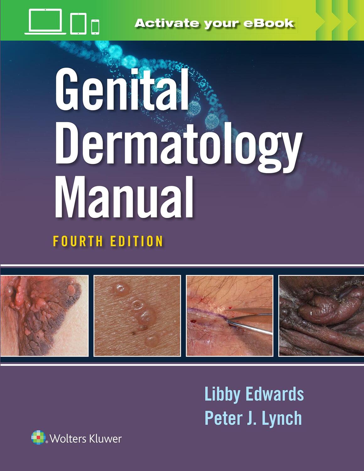 Cover: 9781975161453 | Genital Dermatology Manual | Elizabeth Edwards (u. a.) | Taschenbuch