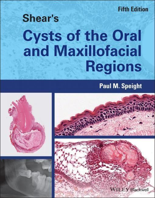 Cover: 9781119354994 | Shear's Cysts of the Oral and Maxillofacial Regions | Paul M. Speight