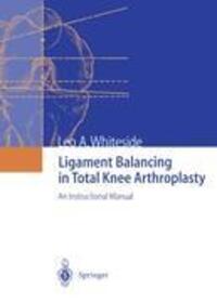 Cover: 9783642639241 | Ligament Balancing in Total Knee Arthroplasty | Leo A. Whiteside | X