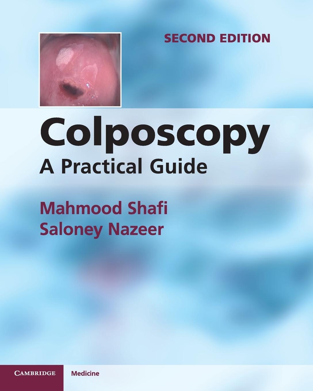 Cover: 9781107667822 | Colposcopy | Mahmood Shafi (u. a.) | Taschenbuch | Paperback | 2018