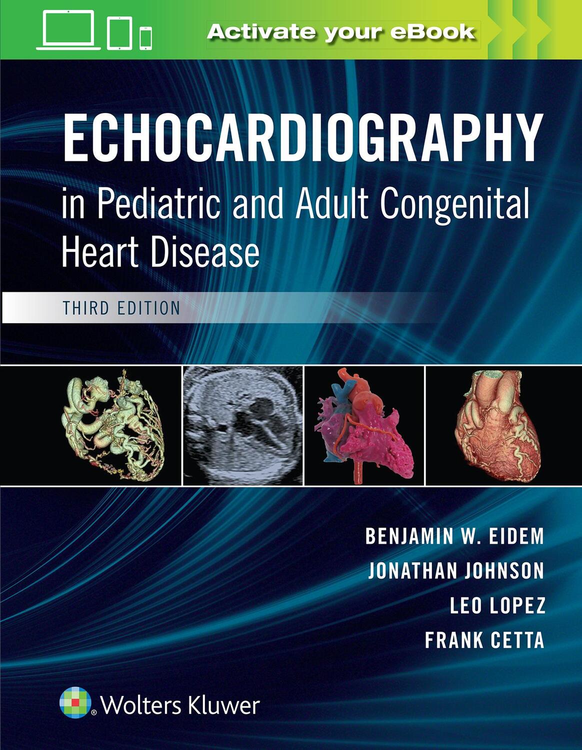 Cover: 9781496394019 | Echocardiography in Pediatric and Adult Congenital Heart Disease