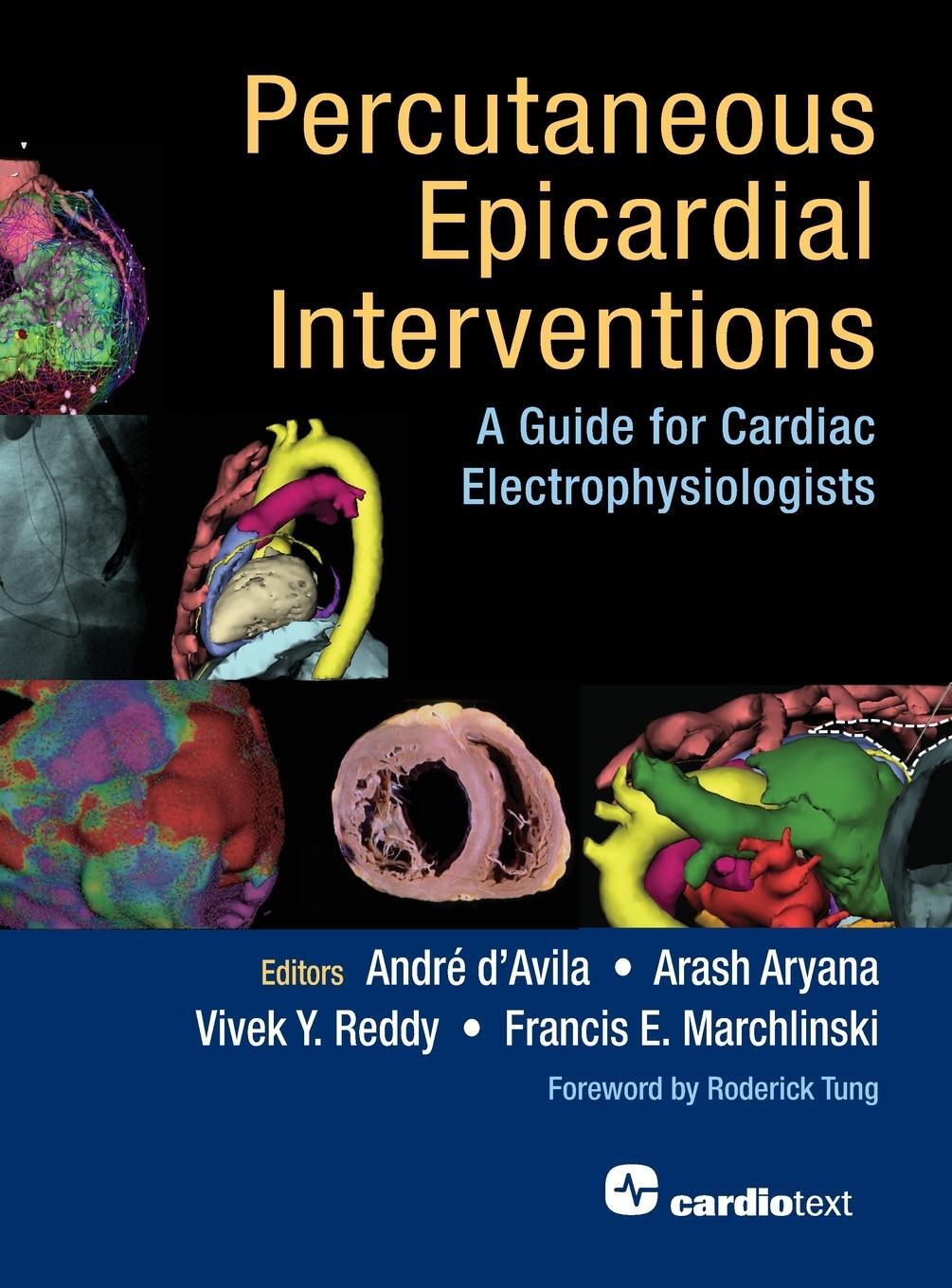 Cover: 9781942909316 | Percutaneous Epicardial Interventions | Vivek Y Reddy | Buch | 2020