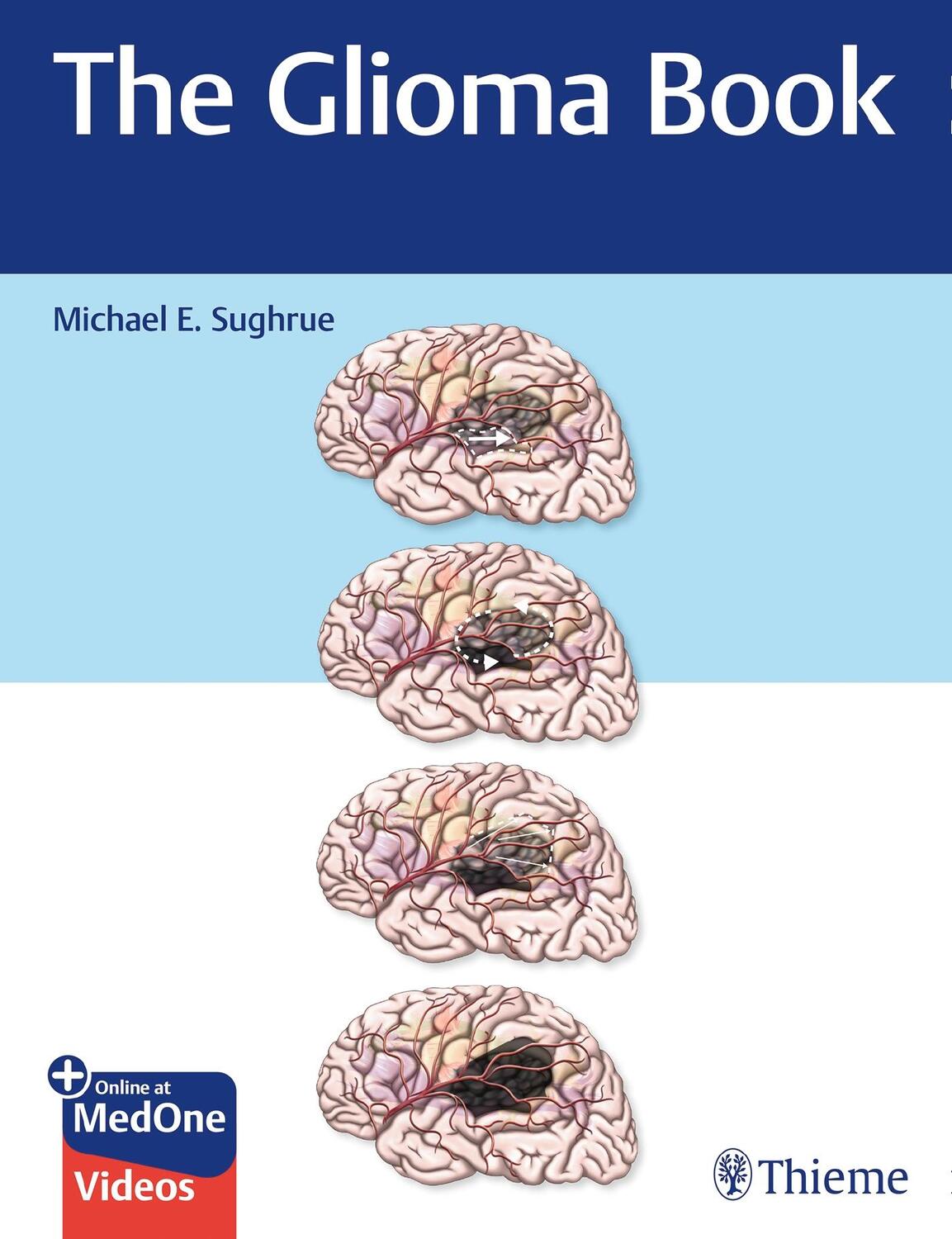 Cover: 9781626234444 | The Glioma Book | Michael E. Sughrue | Bundle | 1 Buch | Englisch