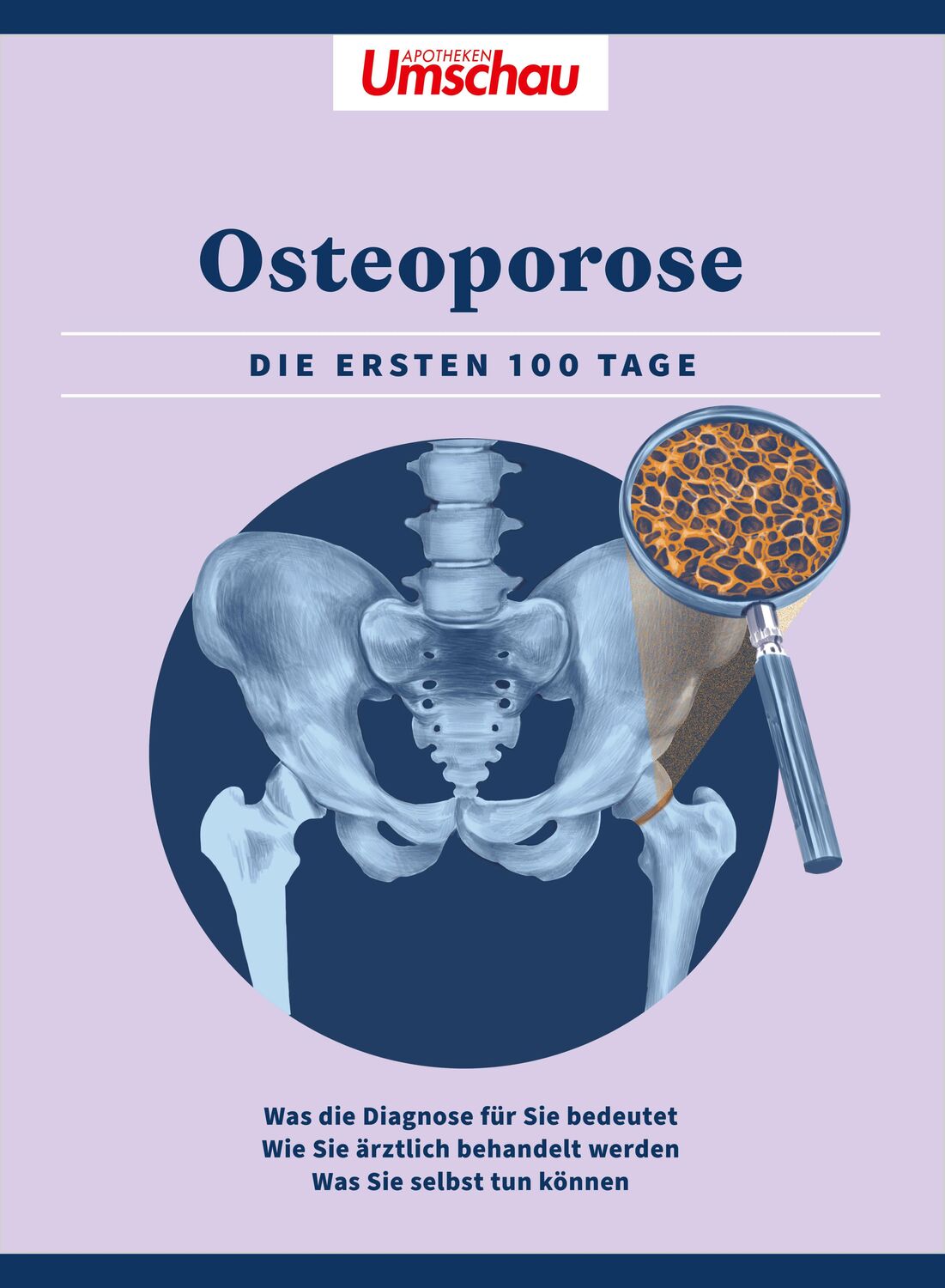 Cover: 9783927216693 | Apotheken Umschau: Osteoporose | Wort &amp; Bild Verlag | Taschenbuch