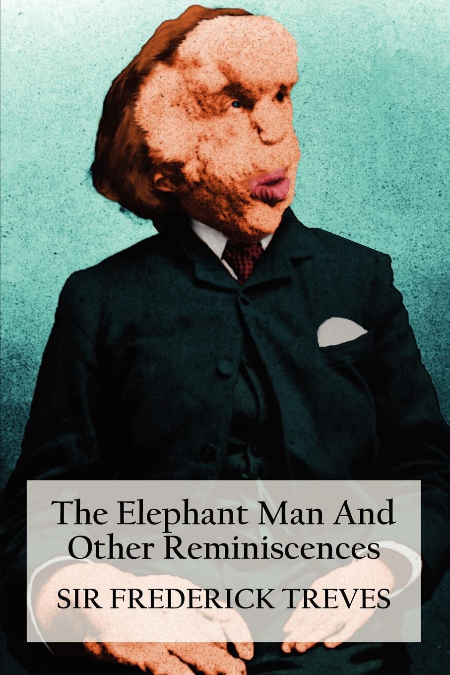 Cover: 9781781391808 | The Elephant Man and Other Reminiscences | Frederick Treves | Buch