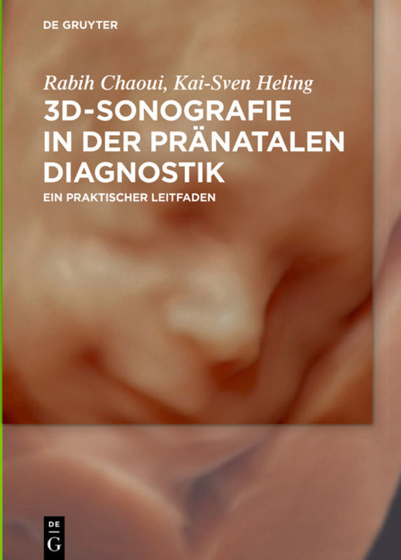 Cover: 9783110471311 | 3D-Sonographie in der pränatalen Diagnostik | Rabih Chaoui (u. a.)
