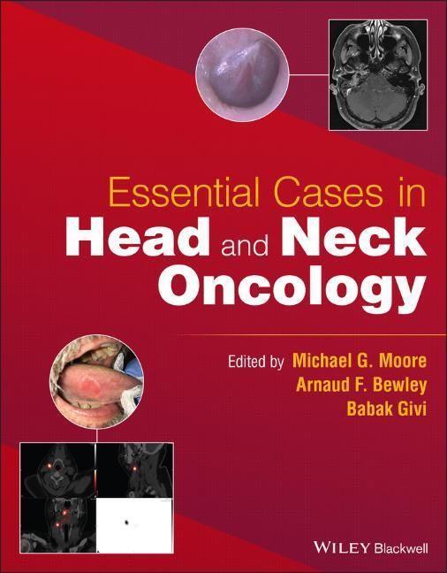 Cover: 9781119775942 | Essential Cases in Head and Neck Oncology | B Givi | Taschenbuch