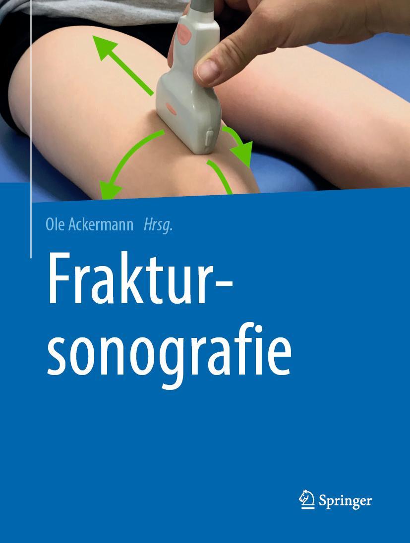 Cover: 9783662585078 | Fraktursonografie | Ole Ackermann | Buch | viii | Deutsch | 2019