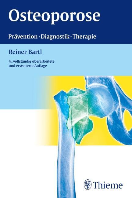 Cover: 9783131057549 | Osteoporose | Prävention - Diagnostik - Therapie | Reiner Bartl | Buch