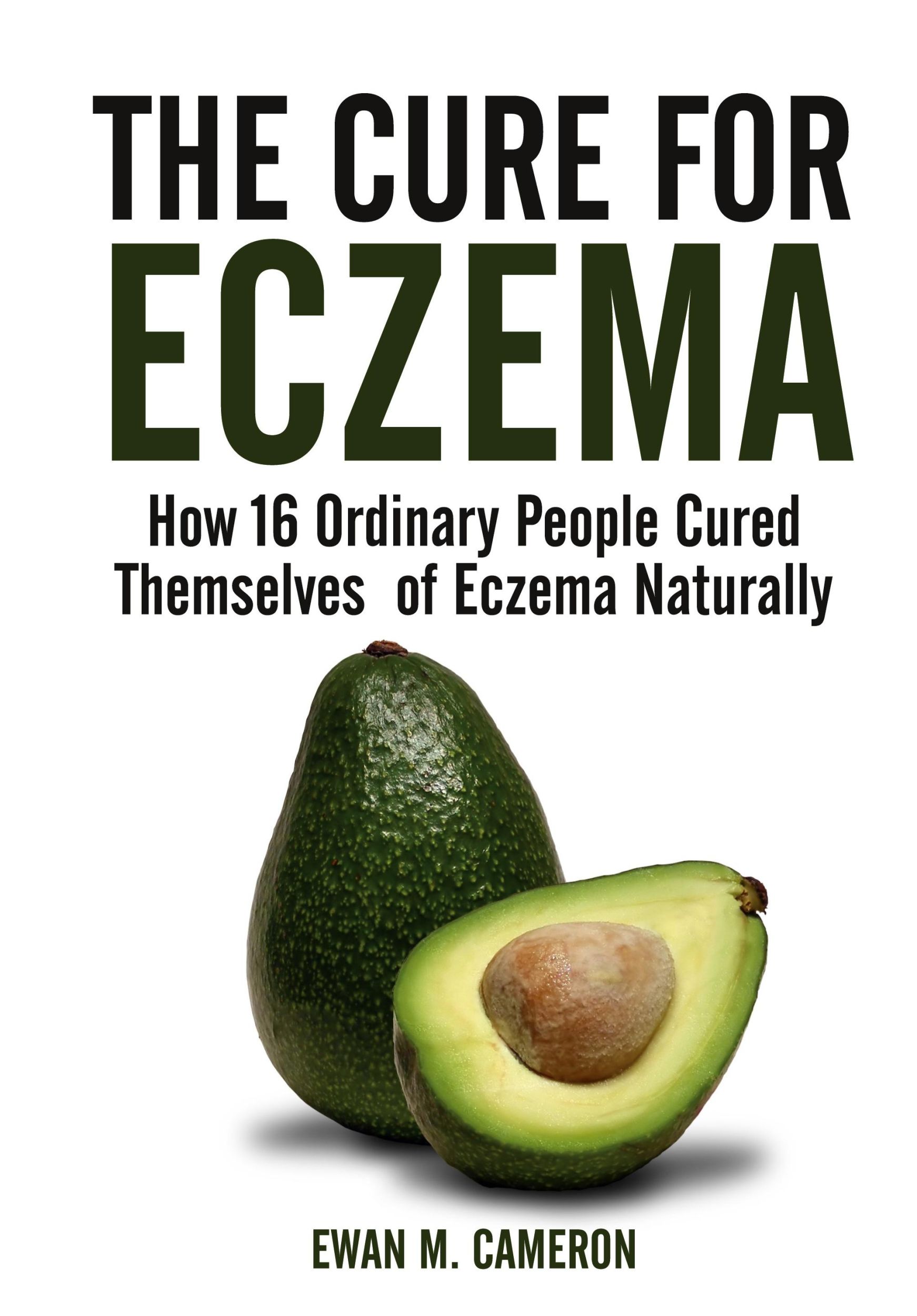 Cover: 9781785550393 | The Cure for Eczema | Ewan M. Cameron | Buch | Englisch | 2017