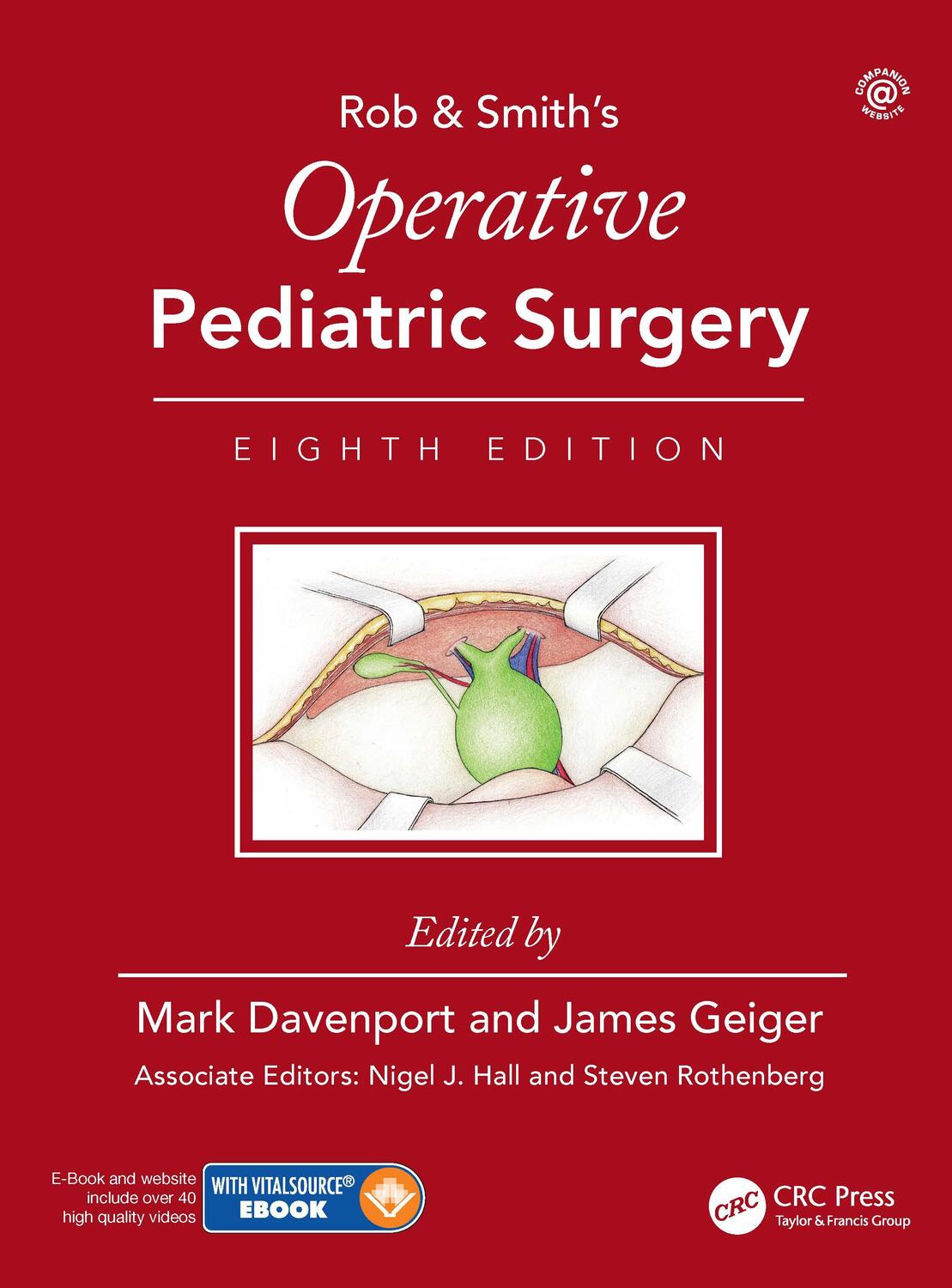 Cover: 9780815370000 | Operative Pediatric Surgery | James Geiger (u. a.) | Buch | Englisch