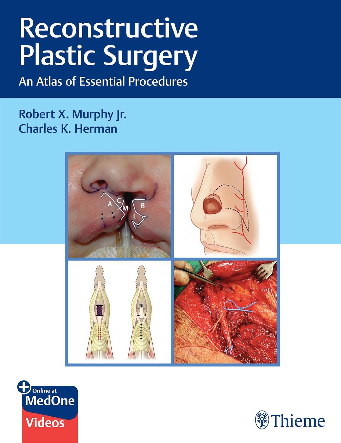 Cover: 9781626235175 | Reconstructive Plastic Surgery | An Atlas of Essential Procedures