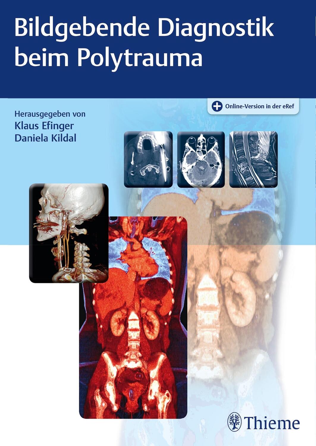 Cover: 9783132007819 | Bildgebende Diagnostik beim Polytrauma | Klaus Efinger (u. a.) | 2019