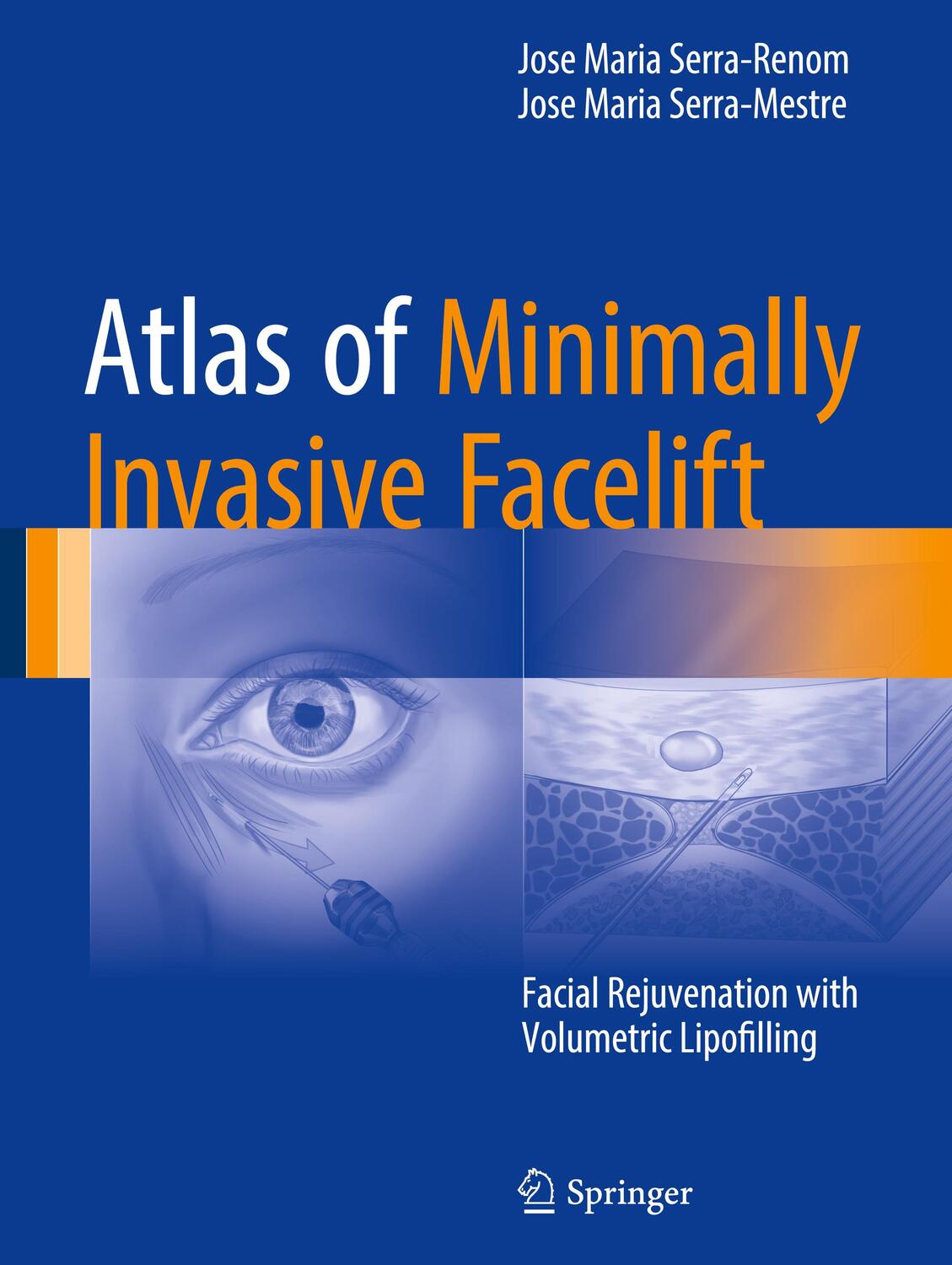 Cover: 9783319330167 | Atlas of Minimally Invasive Facelift | Jose Maria Serra-Mestre (u. a.)