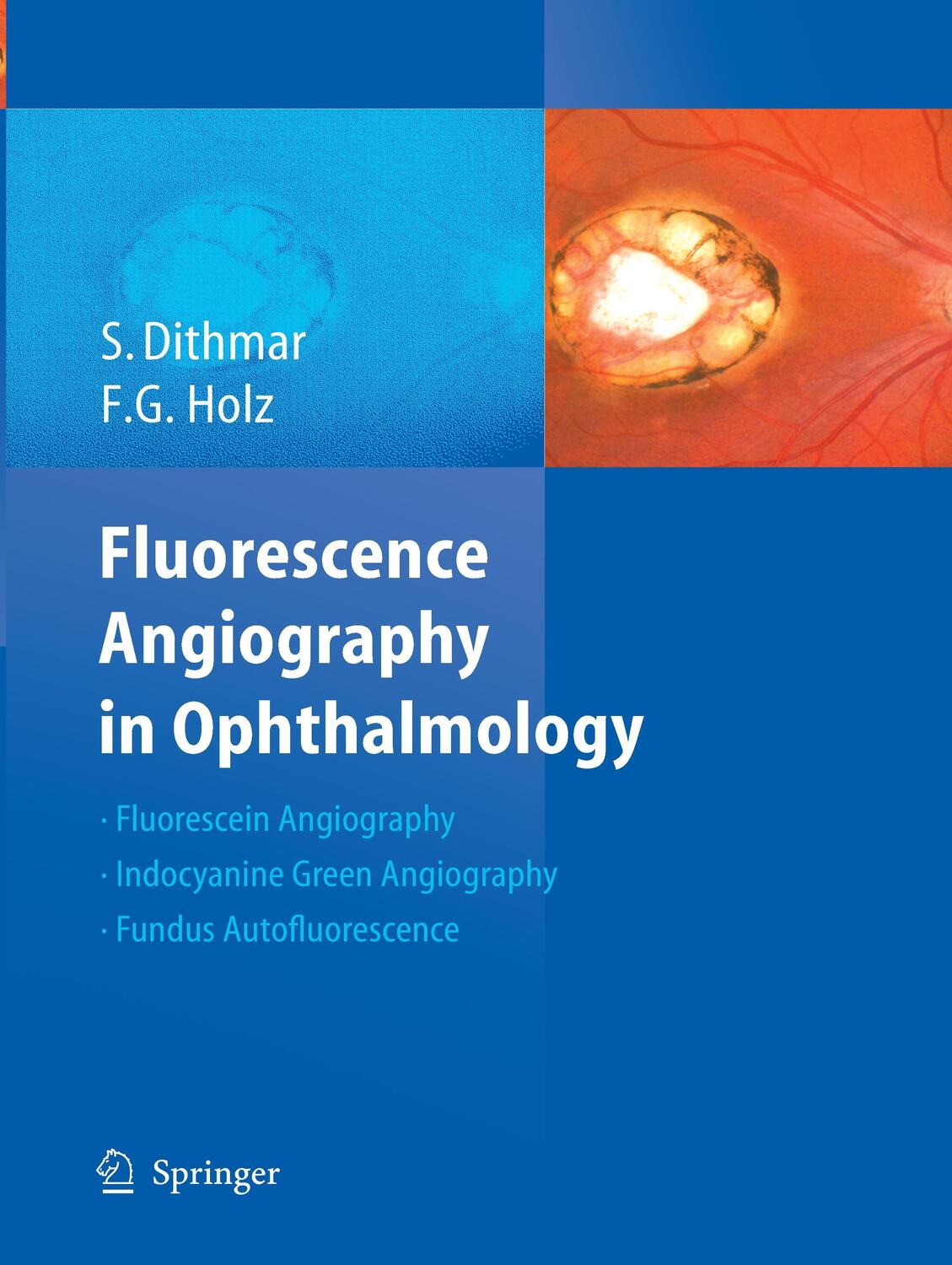 Cover: 9783662517918 | Fluorescence Angiography in Ophthalmology | Frank G. Holz (u. a.)