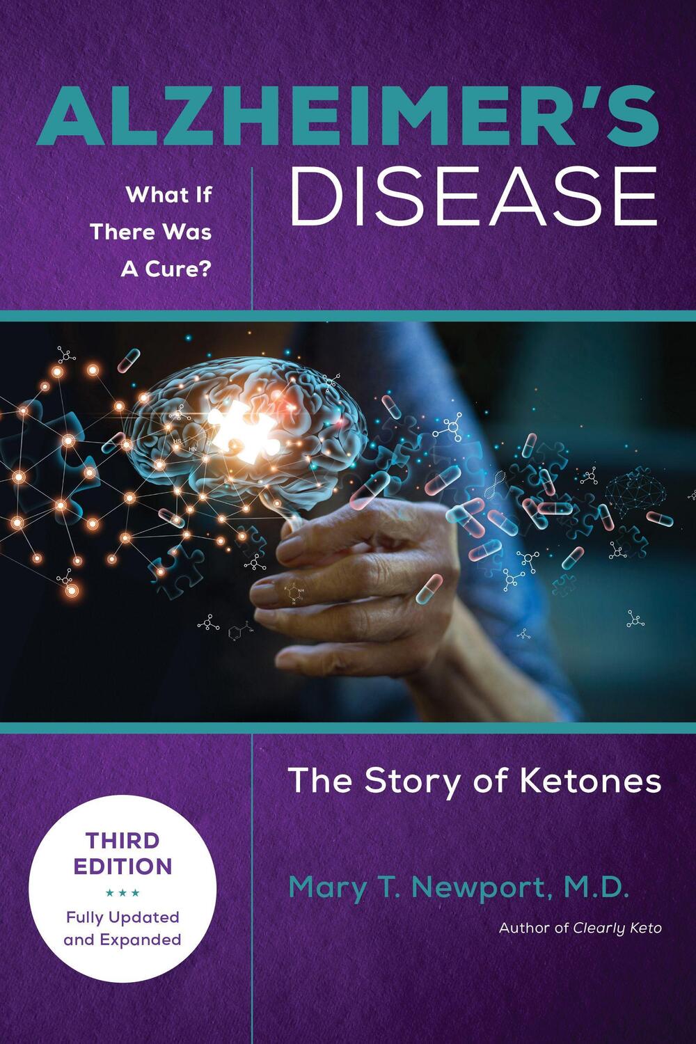 Cover: 9781684429240 | Alzheimer's Disease: What If There Was a Cure (3rd Edition) | Newport