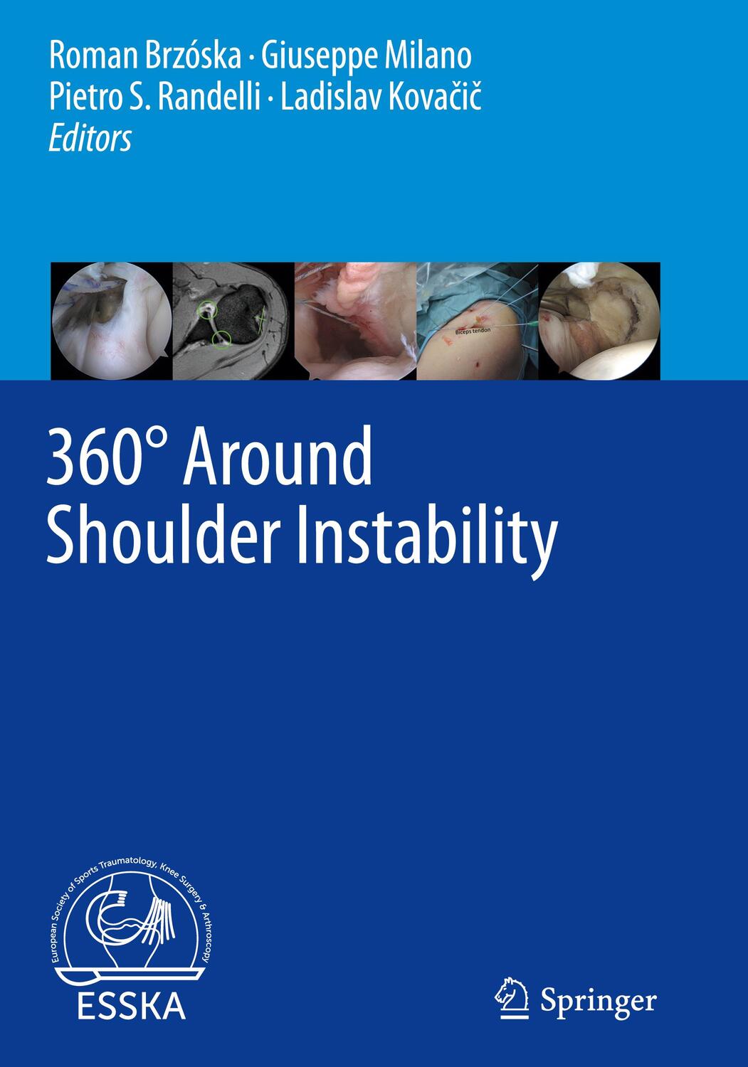 Cover: 9783662610732 | 360° Around Shoulder Instability | Roman Brzóska (u. a.) | Buch | xii