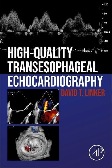 Cover: 9780128229323 | High-Quality Transesophageal Echocardiography | David T Linker | Buch