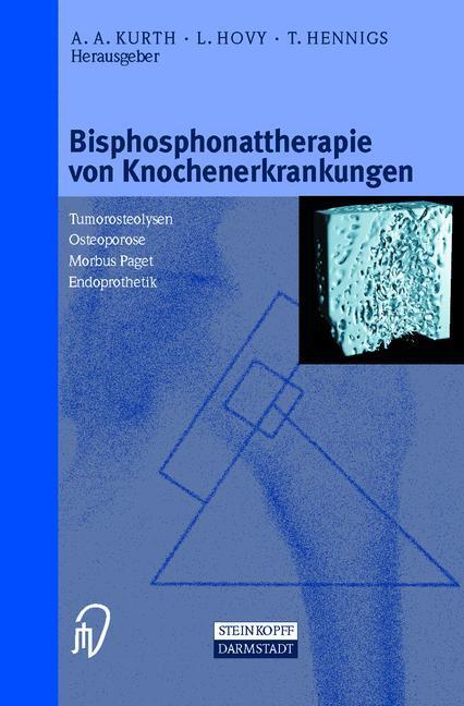 Cover: 9783798512665 | Bisphosphonattherapie von Knochenerkrankungen | A. A. Kurth (u. a.)