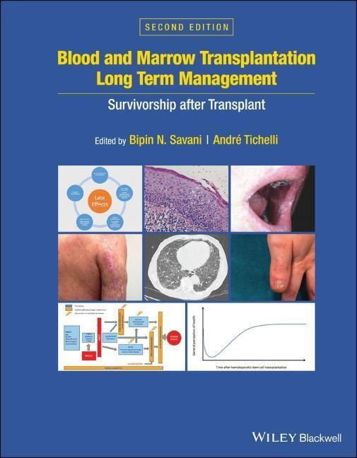 Cover: 9781119612698 | Blood and Marrow Transplantation Long Term Management | Savani (u. a.)