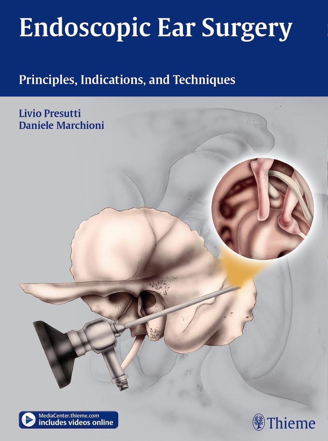 Cover: 9783131630414 | Endoscopic Ear Surgery | Principles, Indications, and Techniques