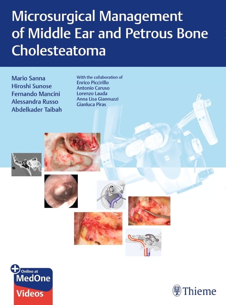 Cover: 9783132000056 | Microsurgical Management of Middle Ear and Petrous Bone Cholesteatoma