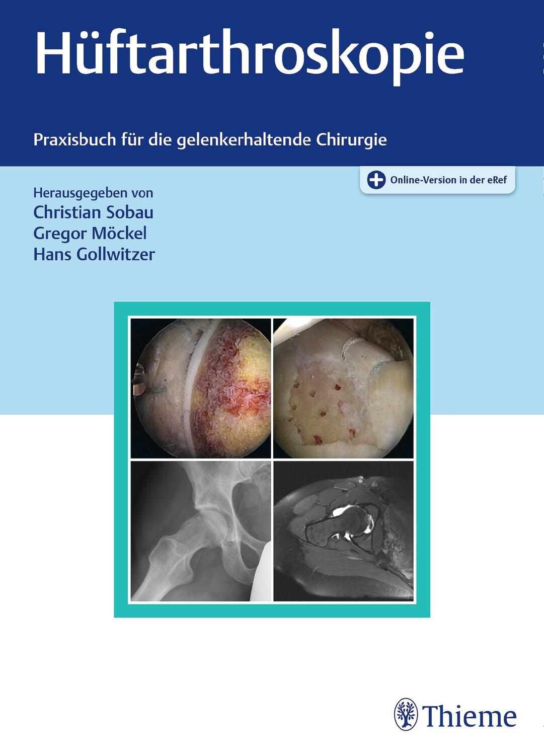 Cover: 9783132422155 | Hüftarthroskopie | Praxisbuch für die gelenkerhaltende Chirurgie