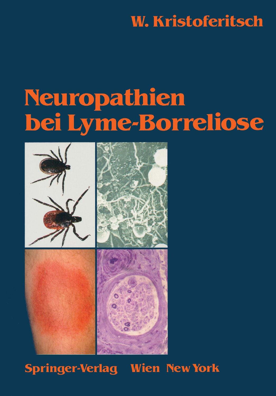 Cover: 9783211821084 | Neuropathien bei Lyme-Borreliose | Wolfgang Kristoferitsch | Buch