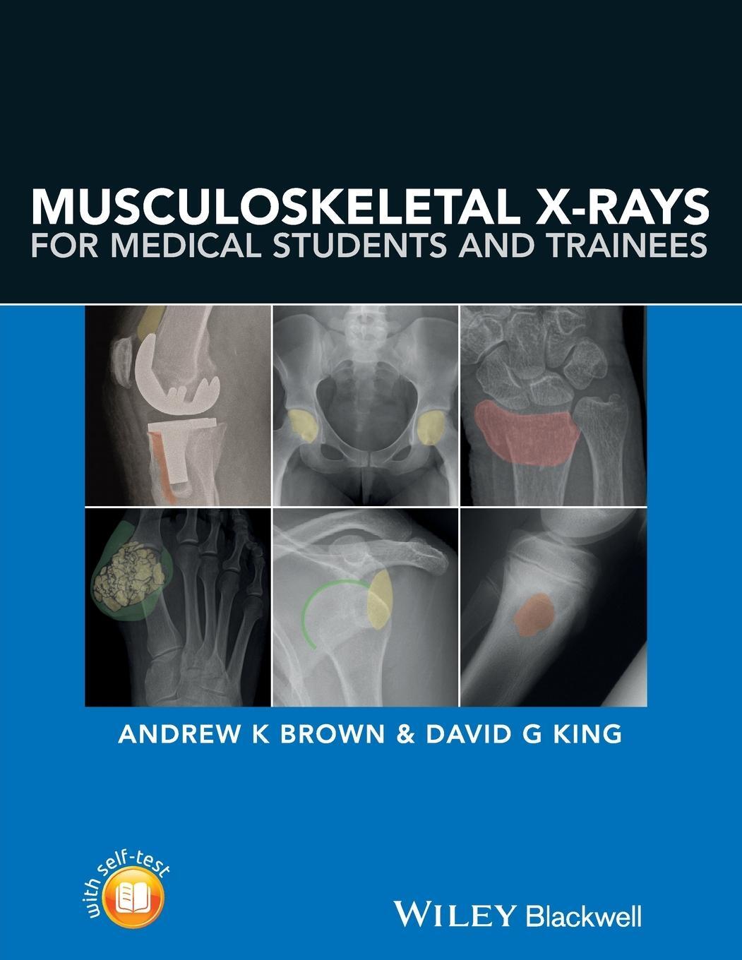 Cover: 9781118458730 | Musculoskeletal X-Rays for Medical Students and Trainees | Taschenbuch