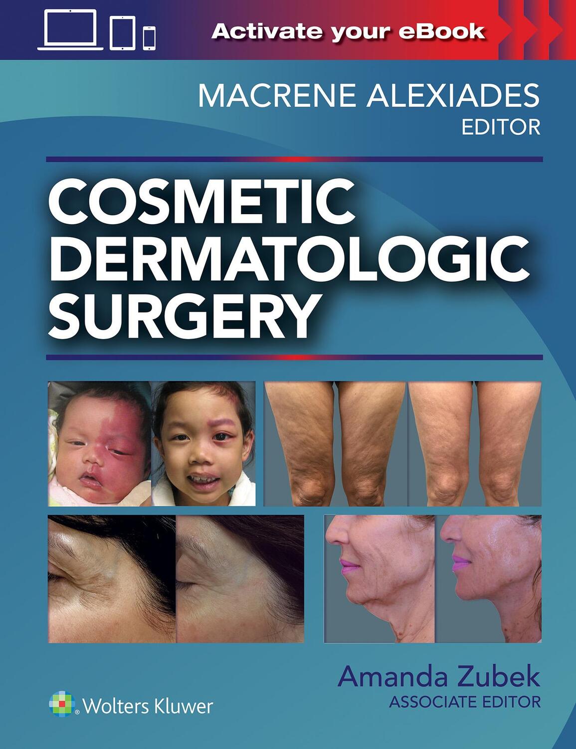 Cover: 9781496344168 | Cosmetic Dermatologic Surgery | Amanda Zubek (u. a.) | Buch | Englisch