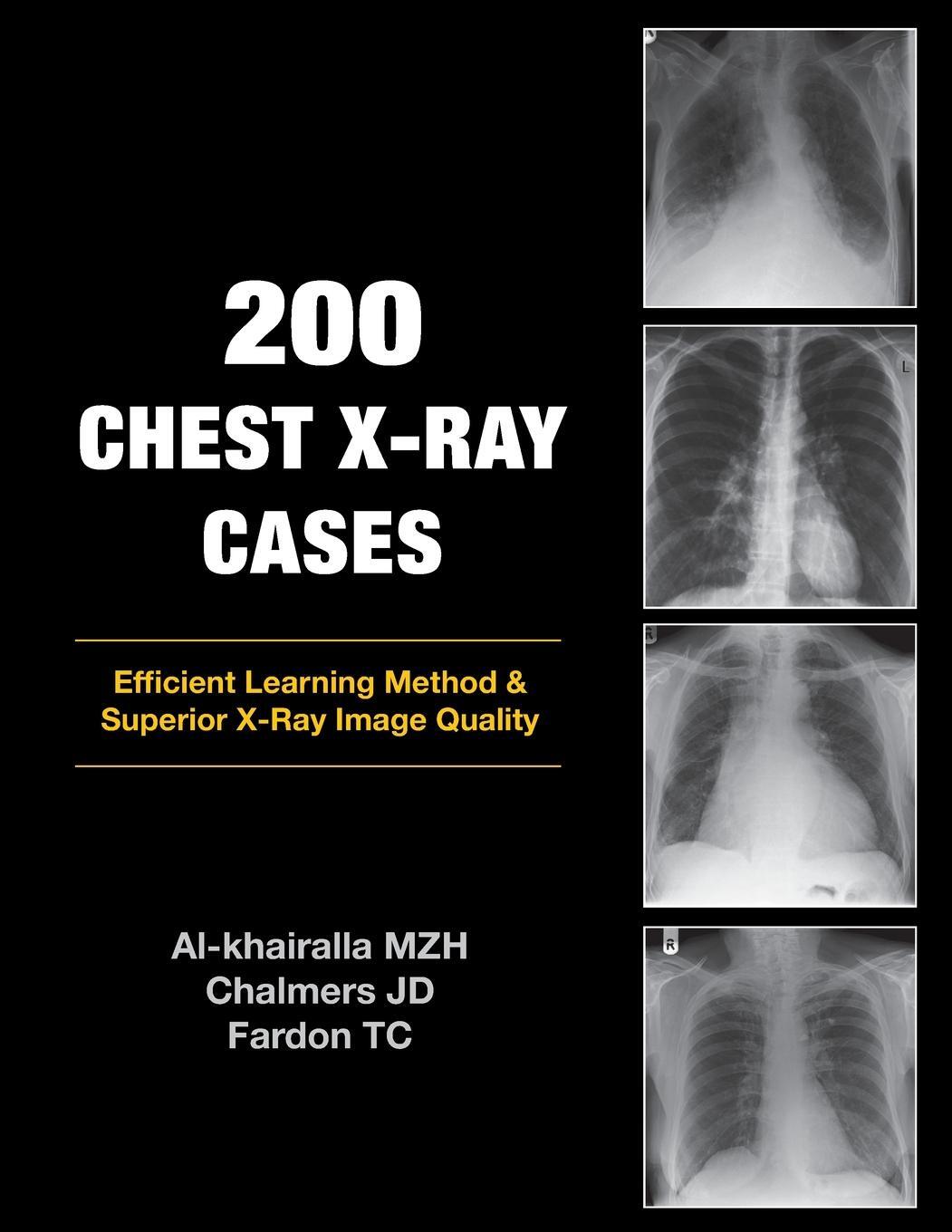Cover: 9781905006366 | 200 Chest X-Ray Cases | Mudher Al-Khairalla (u. a.) | Taschenbuch