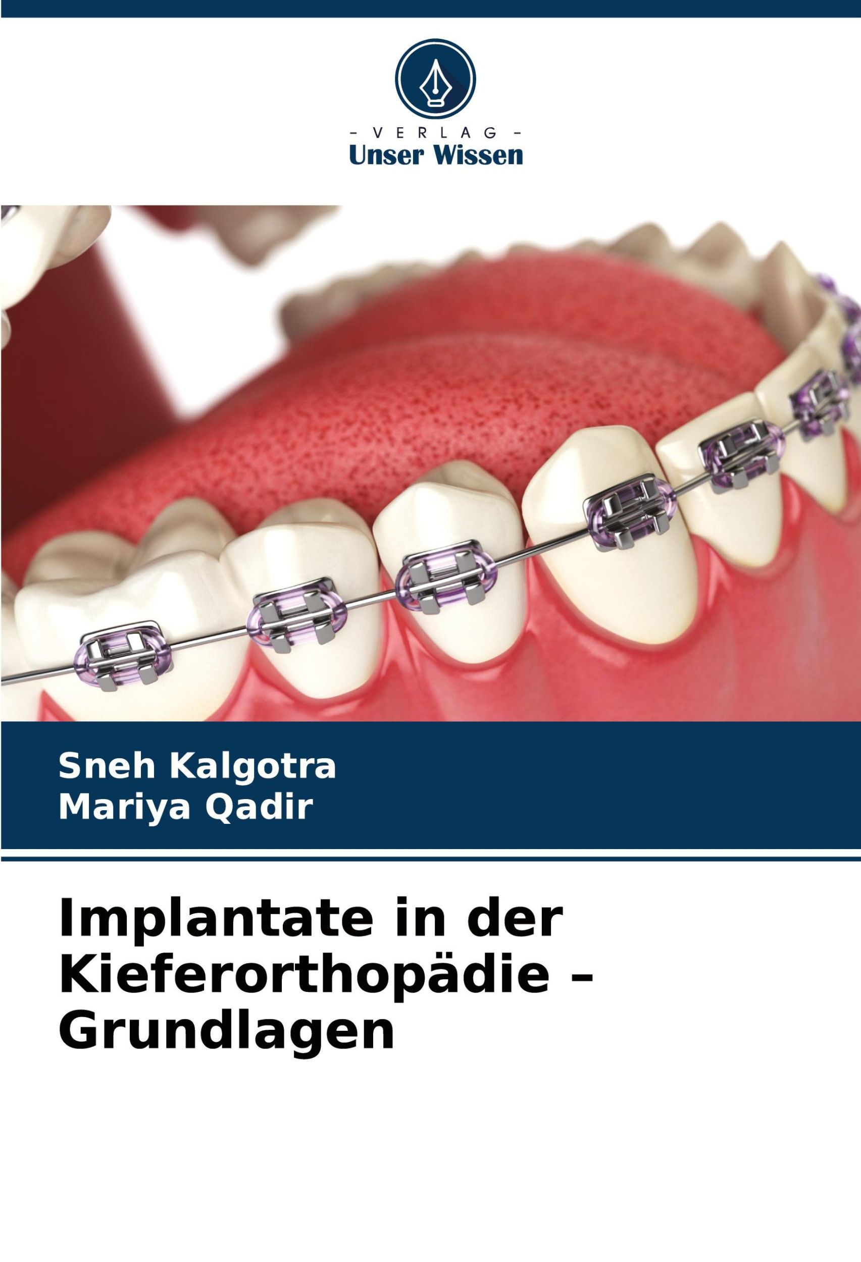 Cover: 9786208131104 | Implantate in der Kieferorthopädie ¿ Grundlagen | Kalgotra (u. a.)