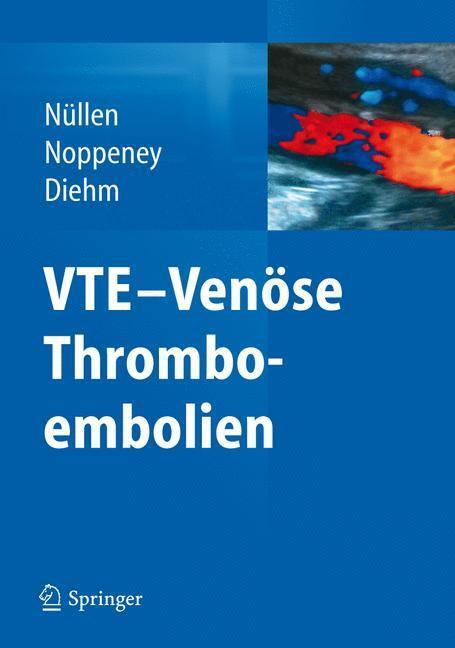 Cover: 9783642214950 | VTE - Venöse Thromboembolien | Helmut Nüllen (u. a.) | Buch | Deutsch