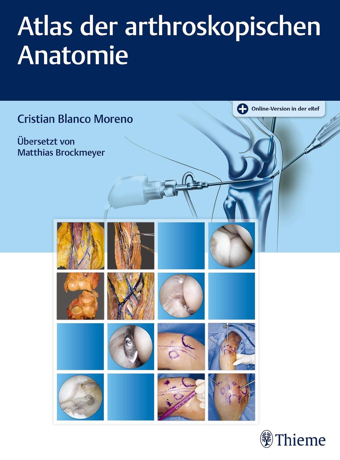 Cover: 9783132053014 | Atlas der arthroskopischen Anatomie | Cristian Blanco Moreno | Bundle