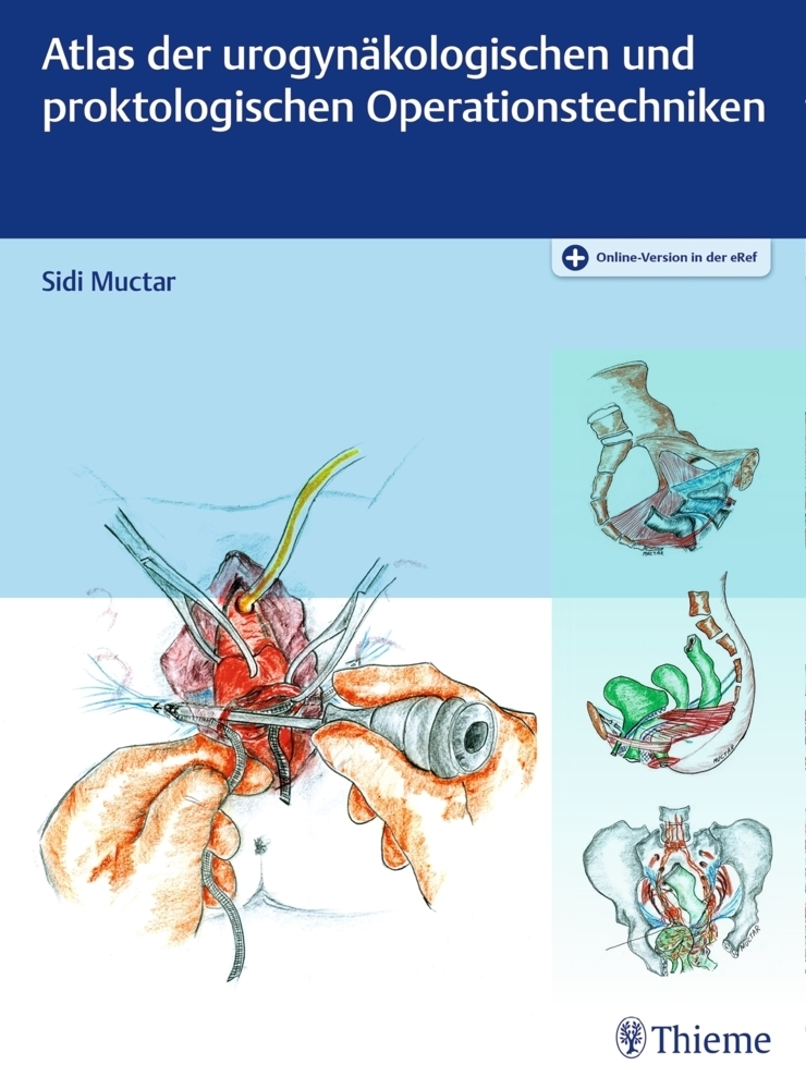Cover: 9783132416796 | Atlas der urogynäkologischen und proktologischen Operationstechniken